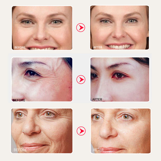 Snail Moisturizing Cream for Repair and Anti-Aging